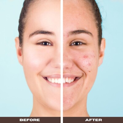 FREE SHIPPING - Explore Home Remedies for Skin Problems with Black Soap