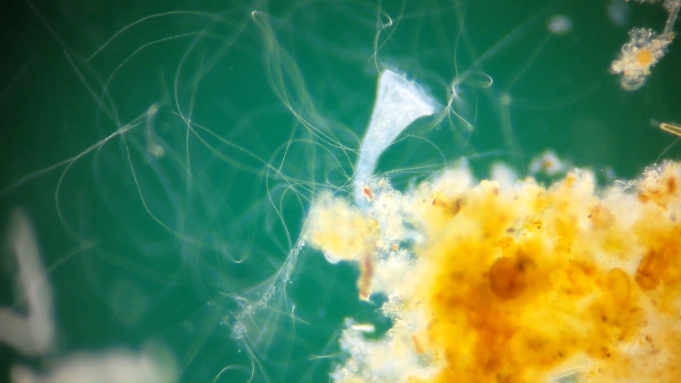 Darkfield Filter Set For Microscope 32mm Mount - 24/20/14/8mm - Foto 2