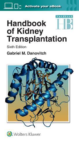 Thumbnail - Gabriel M. Danovitch Handbook Of Kidney Transplantation (taschenbuch)