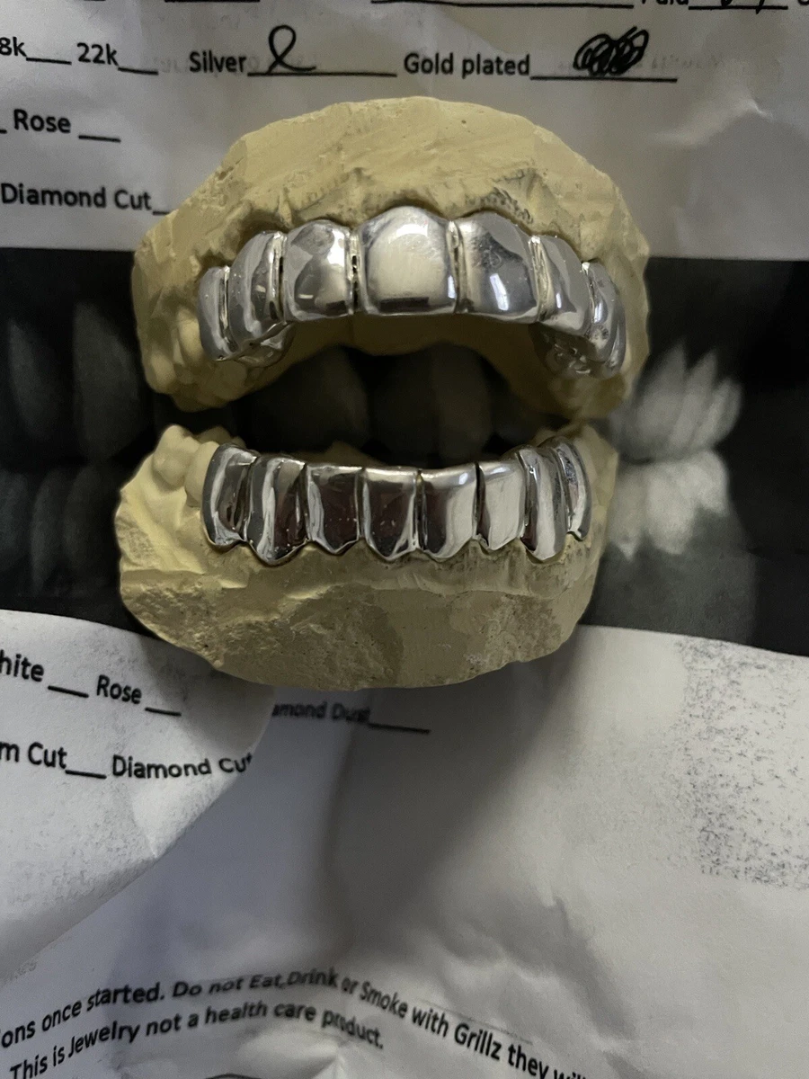 White Gold Grillz