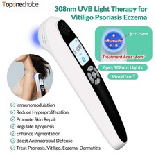 Handheld 308nm UVB Phototherapy Device Portable Skin Light Therapy for Home Use