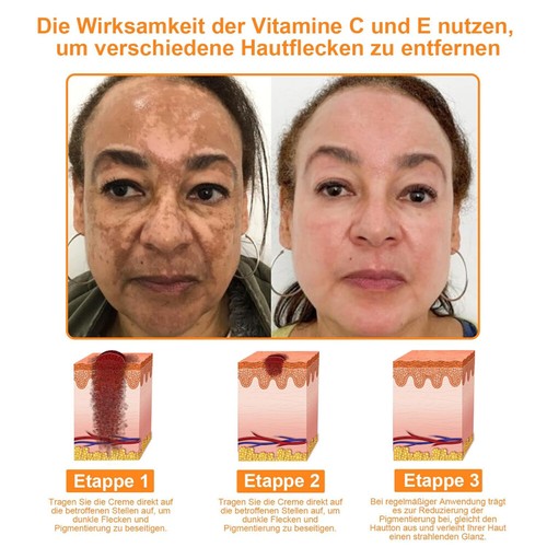 Bienengift Gegen Warzen Creme, Bee Venom Creme Bienengiftwarzen- und Etikettenen - Bild 12 von 15