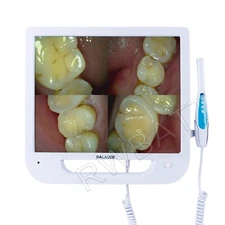 Dental Intra Oral Camera 14 million pixels Endoscope with 17 Inch LCD Monitor