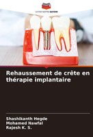 Shashikanth Hegde (U. A.) | Rehaussement De CrêTe En ThéRapie Implantaire | Buch