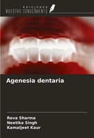 Reva Sharma (U. A.) | Agenesia Dentaria | Taschenbuch | Spanisch (2024)