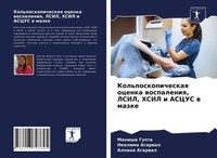 Manisha Gupta (U. A.) | Kol'poskopicheskaq Ocenka Wospaleniq, Lsil, Hsil I...