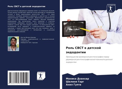 Monika Dhanhar (u. a.) | Rol' CBCT w detskoj ändodontii | Taschenbuch | Russisch