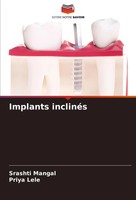 Implants InclinéS Srashti Mangal (U. A.) Taschenbuch FranzöSisch 2024