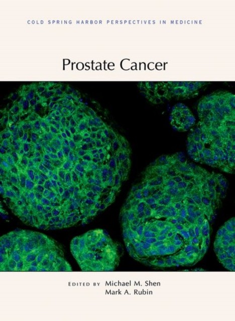 Prostate Cancer by Mark Rubin (Hardback Book)