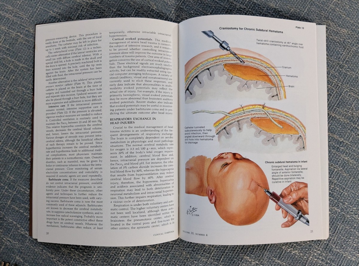 Clinical Symposia Head Injuries William Friedman MD Volume