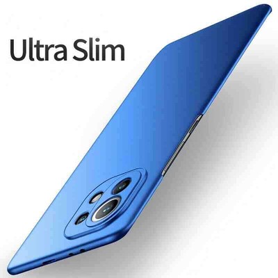 Ultra-thin Matte Hard Case Cover For Xiaomi Redmi Note 11S 11 10 9 Pro K40 Mi 11