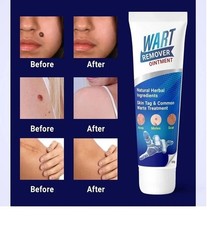 Wart Remover Fast Acting Gel Wart Remover Freeze Off - Fast-Acting 100gm