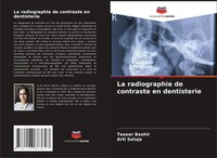 Taseer Bashir (U. A.) | La Radiographie De Contraste En Dentisterie | Buch