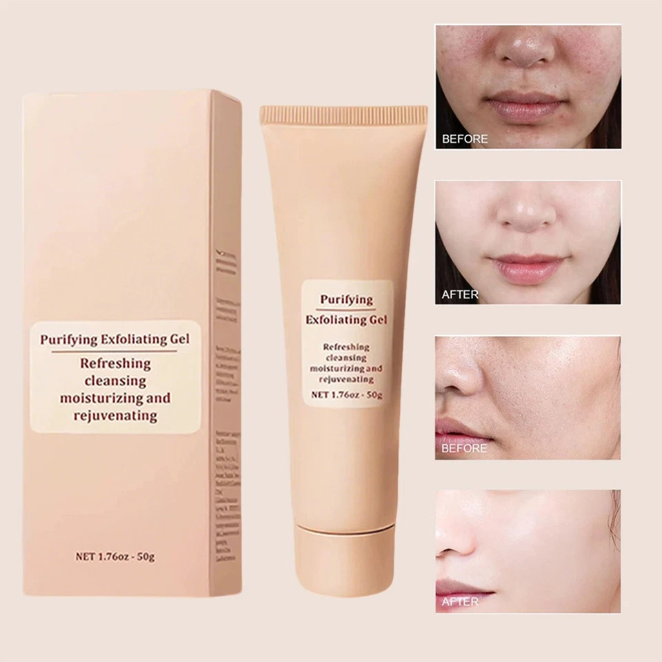 Quarxery Purifying Exfoliating Gel, Purifying Cleansing Cream for Face Body - Image 3 of 4