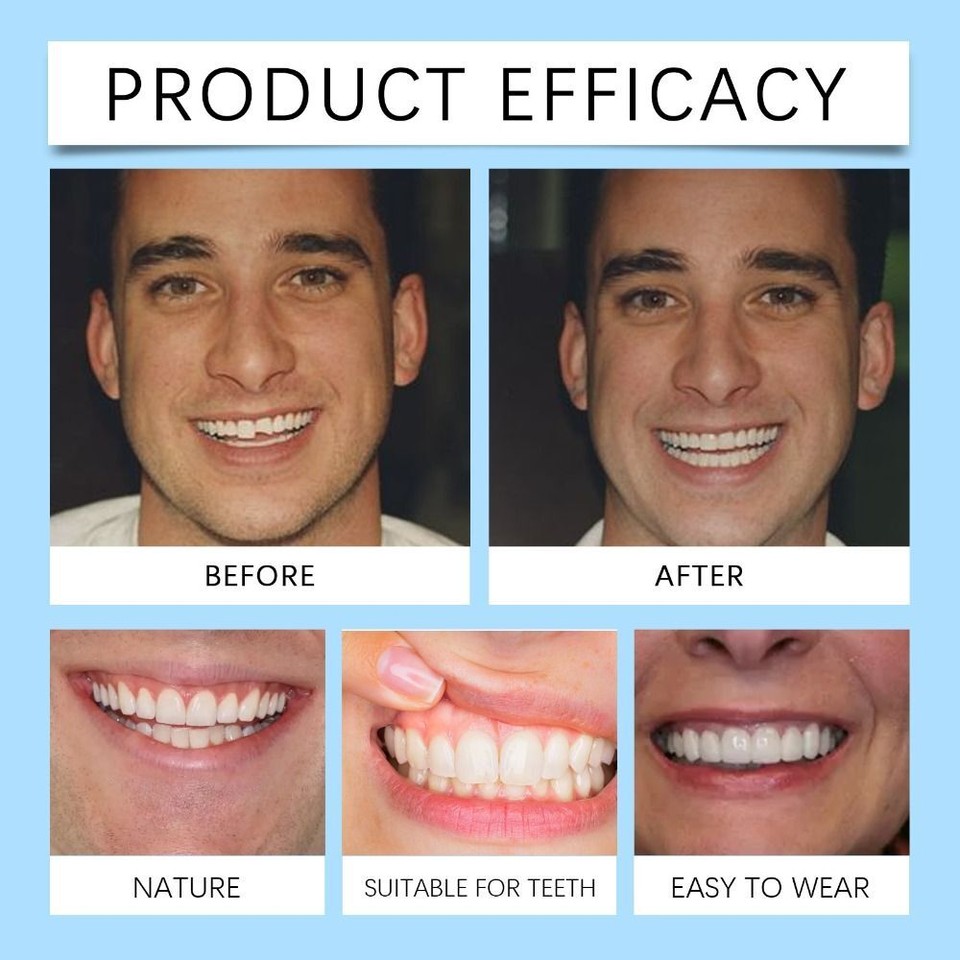 Soft Denture Reline Kit Comfortable And Firm Instant Teeth Unisex eBay