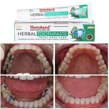 2X Hamdard Herbes Dentifrice Total Hygiène Buccale (100g) Évite Bactérien