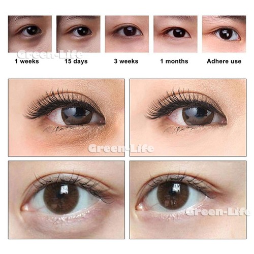 Under Eye Patches - 10 Pairs 24K Gold Eye Mask Power Crystal Gel Collagen Masks - Picture 9 of 17