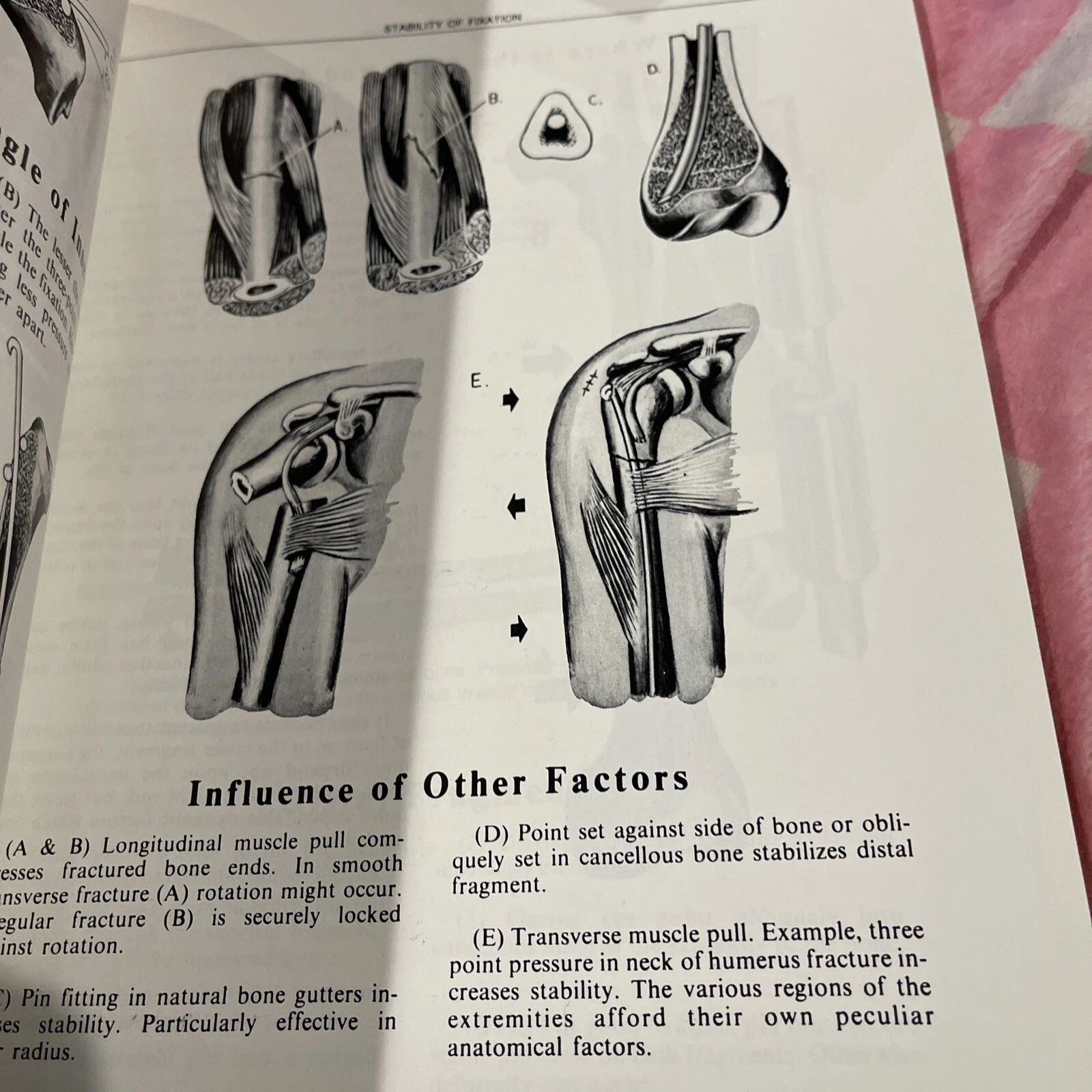 Picture 18 of 20