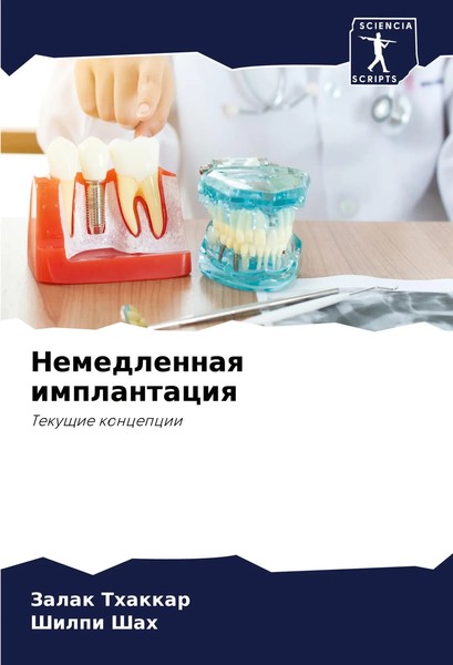 Zalak Thakkar (U. A.) | Nemedlennaq Implantaciq | Taschenbuch | Russisch (2023)-image