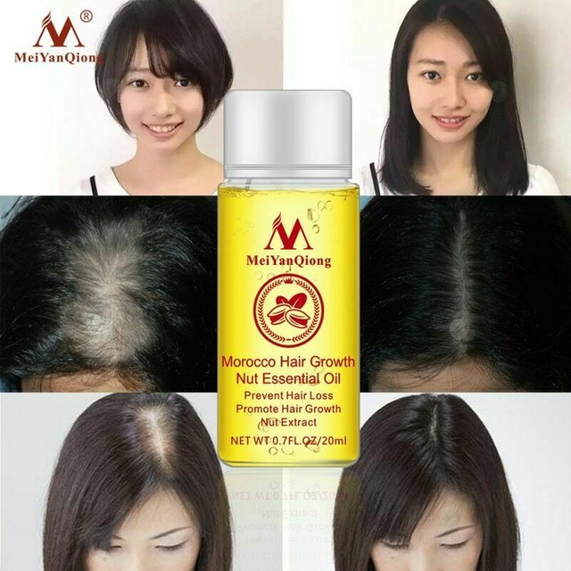 Tratamiento Para La Caida Del Cabello GARANTIZA Un