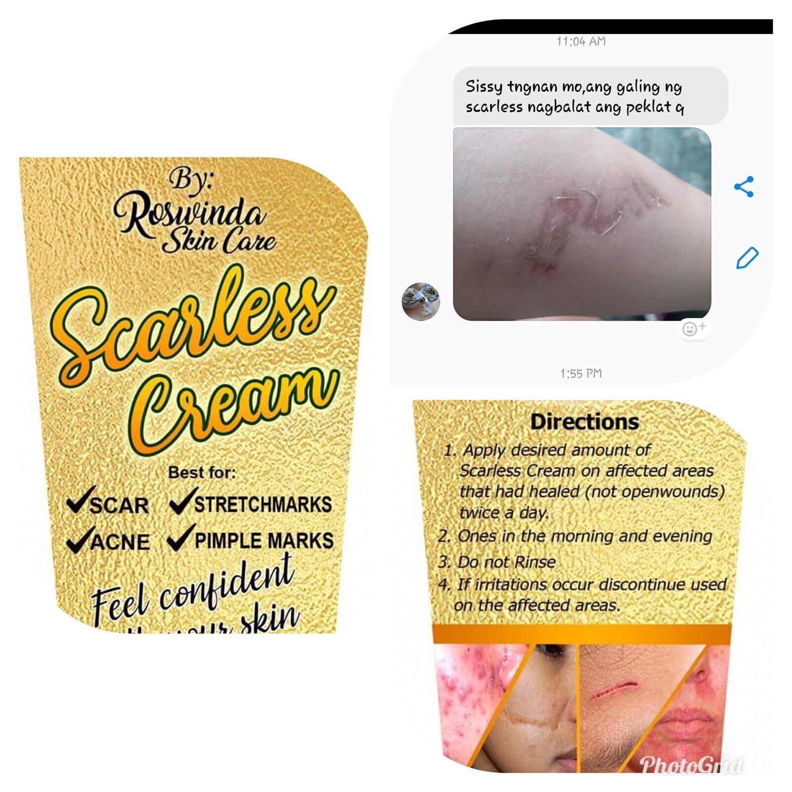 Scarless Cream Lightening Stretch Scars 世界的に有名な 有名な Mark
