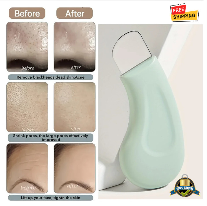 1 Pc Blackhead & Whitehead Removal Tool For Nose And Face Pore Cleaning