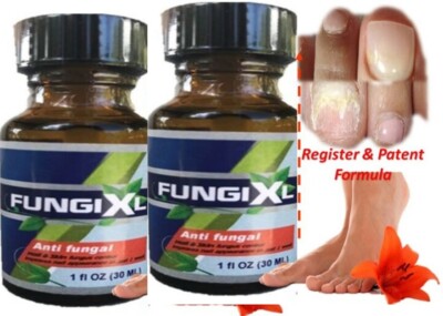 ANTI-FUNGAL MAXIMUM STRENGTH TOENAIL FUNGUS ATHLETES FOOT FUNGI NAIL SUPPORT