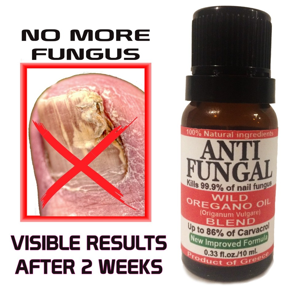 Oil Of Oregano For Foot Fungus