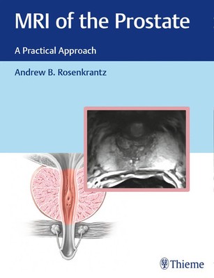 MRI of the Prostate | A Practical Approach | Andrew Rosenkrantz | Englisch