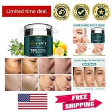 Professional Dark Spot Remover - 1.7 OZ Cream for Melasma & Acne Marks Treatment