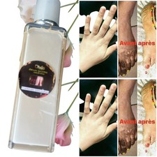AUFHELLENDE LOTION DUO ANTI QUINTOS, FLECKEN für Füße und Hände 