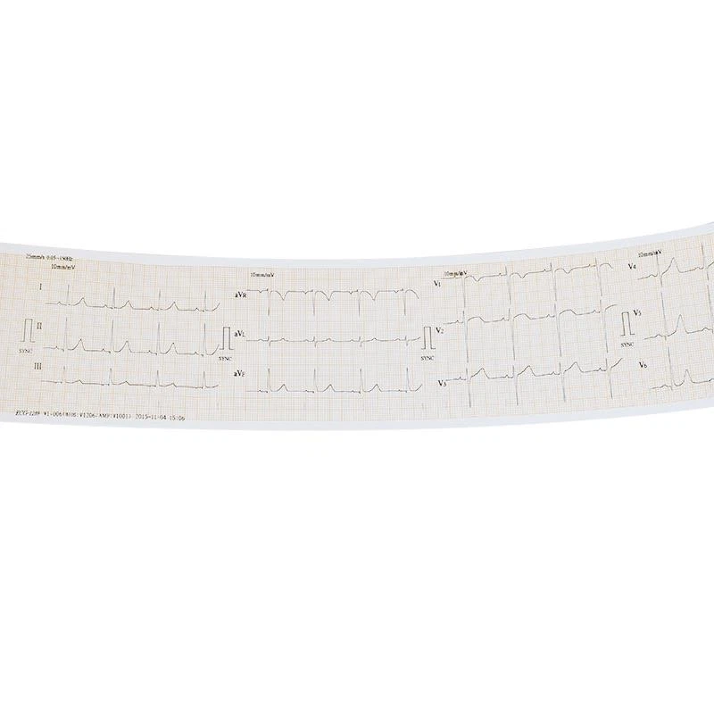 Electrocardiógrafo portátil de 7" 12 cables y 3 canales Foto 4 de 4