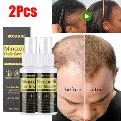 BOTASUN 2X Minoxidil 5% Hair Regrowth Treatment Spray Serum Hair Thinning and Hair Loss