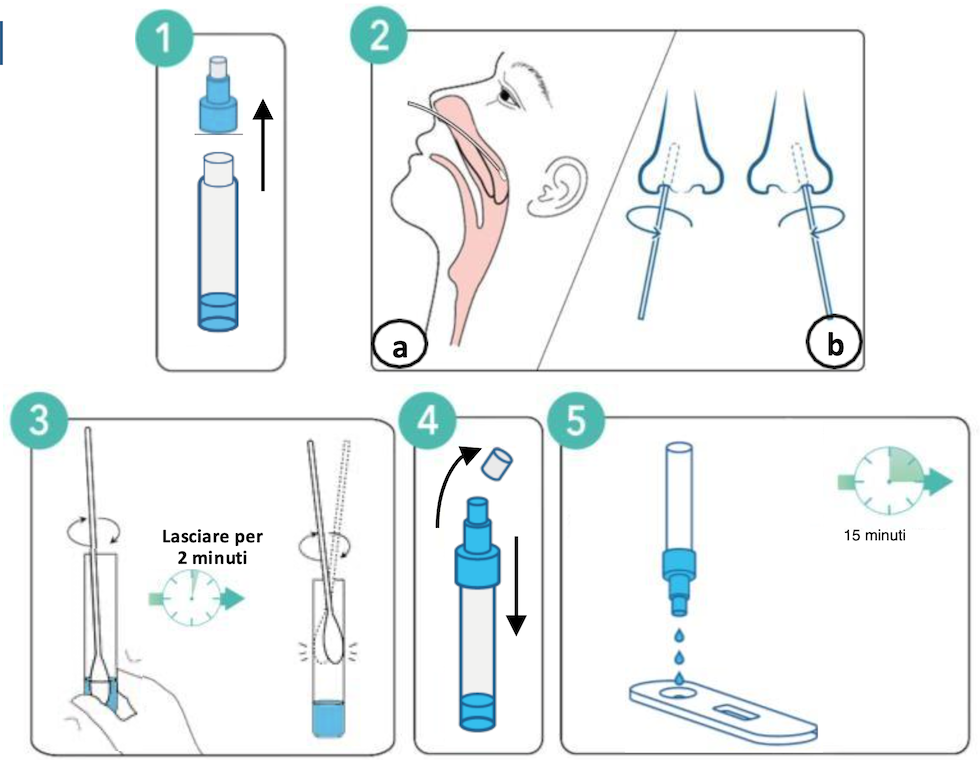 5 Tampone tamponi rapidi antigenici Sarscov2covid 19 bocca e nasale