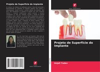 Projeto De SuperfíCie Do Implante Anjali Yadav