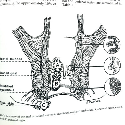 Controversies In Colon Cancer Problems in General Surgery 3 Books Hardcover 1987