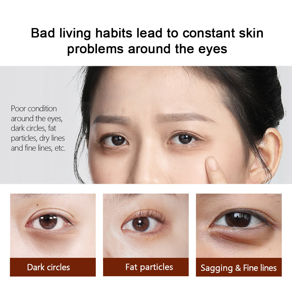 Magic Eye Cream28 Seconds Instant Remove Eye Bags&dark Circles&eye