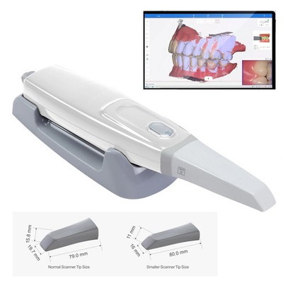 Intraoral Scanner Dental Digital Imaging Intraoral Orthodontic Impression Device