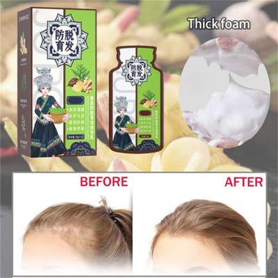 Ginger Plant Extract Anti-Hair Loss Hair Shampoo Soften and Condition 10*20ml