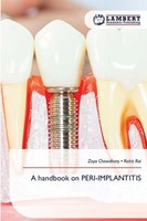 A Handbook On PERI-IMPLANTITIS Zoya Chowdhary (U. A.) Taschenbuch Englisch 2025