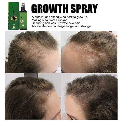 30ml/ 120ml Neo Hair Lotion Hair Root HAIR BEARD SIDEBURNS LONGER Herbs 100 ✨p - Picture 15 of 17