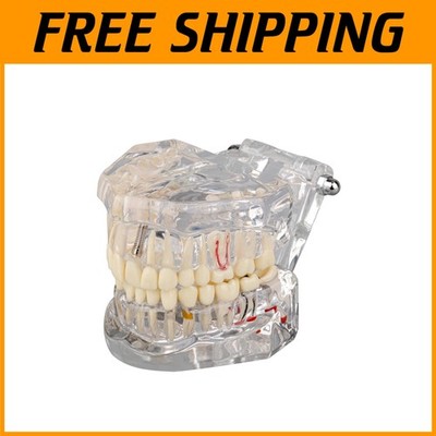 Transparent Dental Model for Clear Visualization