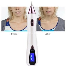 Electric LCD Laser Pen Skin Tag Freckle Wart Spot Remover Tattoo Removal / USA
