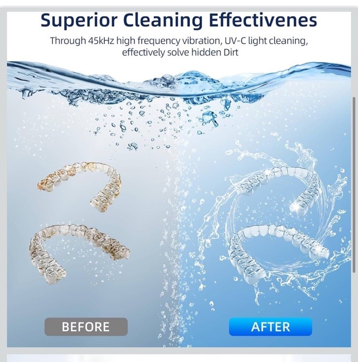 ECOBASIC ULTRASONIC RETAINER CLEANER MACHINE DENTURES MOUTH GUARDS - BLACK !!