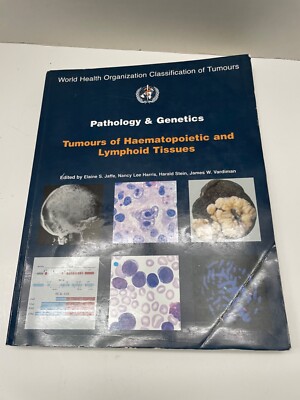 Pathology and genetics of tumours of the haematopoietic and lymphoid tissues