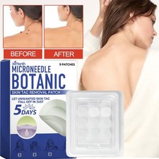 1 Box / 9 pcs MICRONEEDLE BOTANIC Skin Tag  Acne Patch Skin Tag Remover Patches
