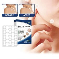 720  Skin Tag Remover Patches Quick Effective Mole Wart Removal Pad Sticker