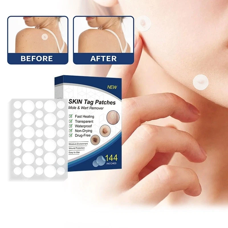 Skin Tag Remover Patches Quick Effective Mole and Wart Pad Removal Sticker US - Image 3 of 4