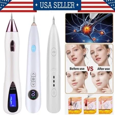 Electric Laser Plasma Mole Removal Pen Dark Spot Remove Skin Wart Tag Tattoo LCD
