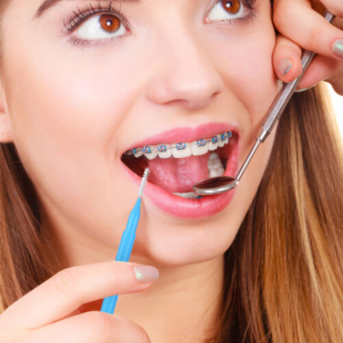 Cleaning Braces Brushes Hygiene Flosser Toothpicks Cleaners Oral Cleaning Tools - Picture 9 of 10